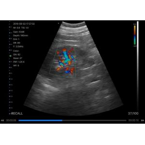 Digital Mobile Handheld Portable Ultrasound Device Convex + Linear + Cardiac