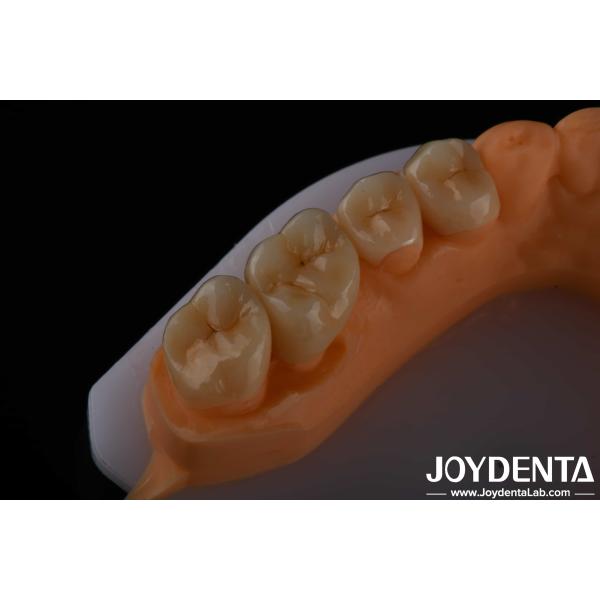 High Aesthetics Full Contour Zirconia For Crowns Bridges Implants Dental