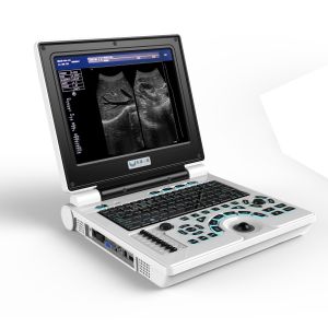 Clinic Doppler Portable Veterinary Ultrasound Machine Li Battery For Dog