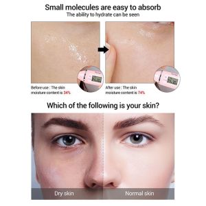 Mopoyat hyaluronic Acid Serum