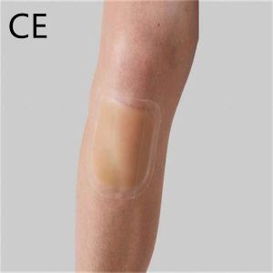 Medicated Moist Wound Care Dressing Antitear Antibacterial Adhesive