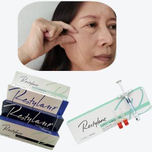 Quality Cross Linked Dermal Filler HA Fillers for Glabellar Lines Injection for sale