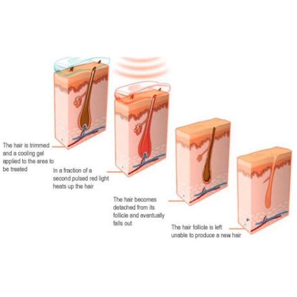 Multi - Function Beauty Salon E-light IPL RF Hair Removal Skin Rejuvenation Machine