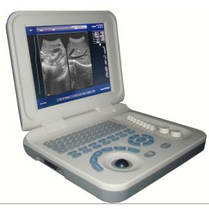 Diagnostic Laptop Ultrasound Machine Digital Ultrasound Scanner Durable