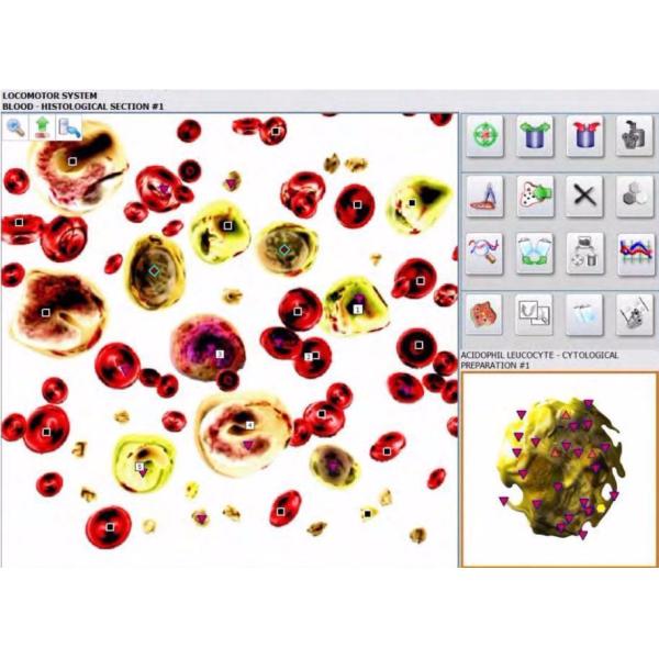 Metatron hunter 4025 with german software