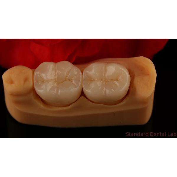 Full Contour Zirconia Crown Exceptional Strength and Esthetics No Porcelian Overlay Posterior Crown China Dental Lab