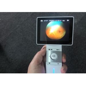 Ideal System For Telemedicine Application Portable Fundus Camera With 45° Auto
