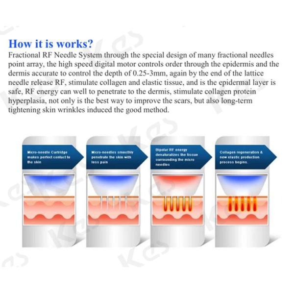 Portable 2MHz 10w Radio Frequency Microneedling Machine