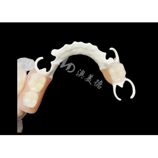 Buy Custom Cast Partial Denture with HPP framework for Enhanced Chewing and Speech at wholesale prices