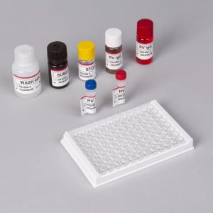 China RV-G Elisa Test Kit For Plasma Sample Type Diagnosis on sale China RV-G Elisa Test Kit For Plasma Sample Type Diagnosis on sale
