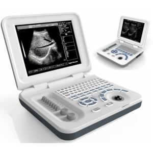 DRF RDA Portable Ultrasound Scanner Li-ion Rechargeable Battery