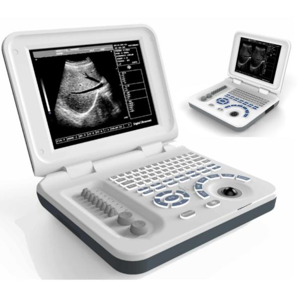 DRF RDA Portable Ultrasound Scanner Li-ion Rechargeable Battery