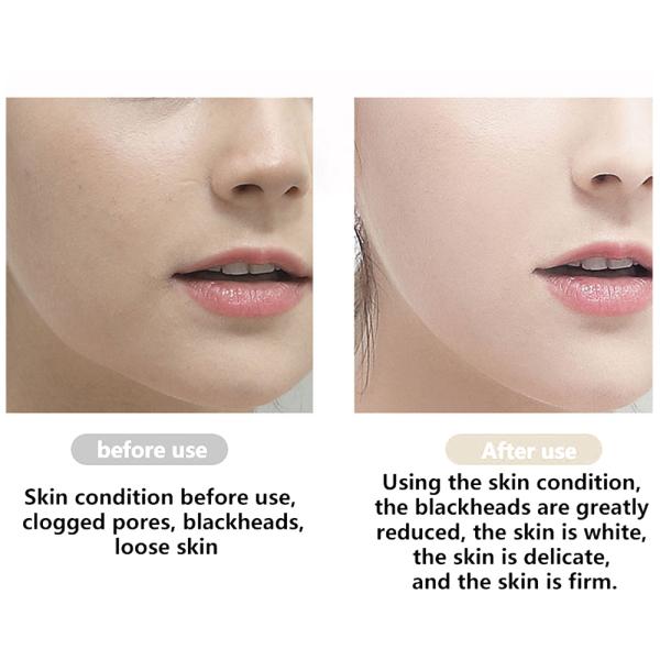 Ultrasonic Skin Scrubber Deep Cleaning Face Scrubber Vibrating Facial Cleansing Skin Spatula Peeling Beauty Instrument D