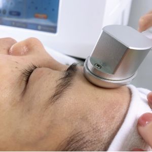 10.4'' Microneedling Fractional RF Face Lifting Skin Tightening