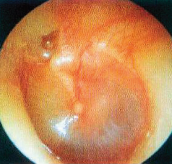 Advanced right ear inspection Clinical simulation for hospital training