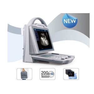 Mobile Ultrasound Scanner Portable Ultrasound Scanner with Transvaginal Linear