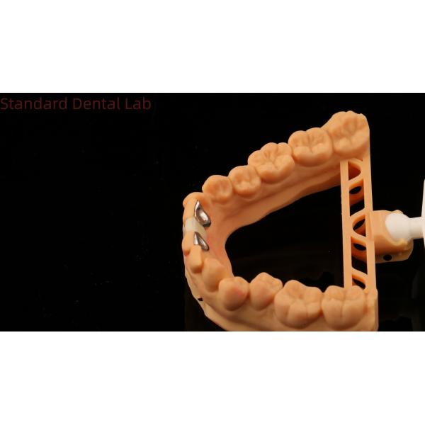 Dental PFM Maryland Bridge High Esthetics FDA Certified With Vita Porcelian China Dental Lab