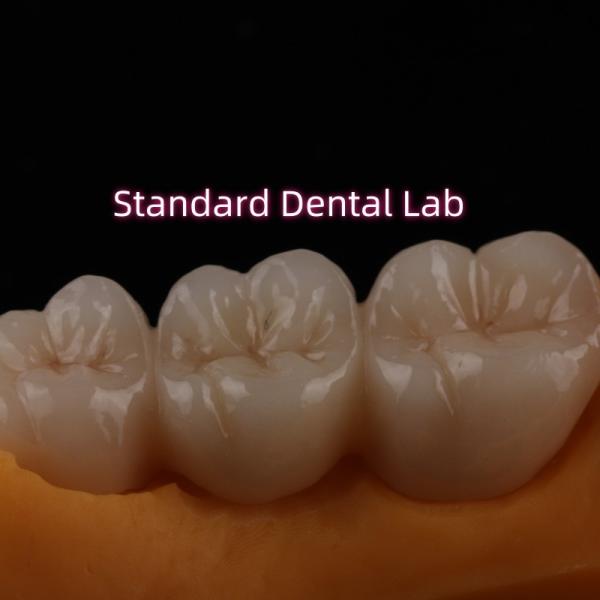 Crown All Porcelain Ceramic Zirconia Ivoclar Esthetic Teeth OEM
