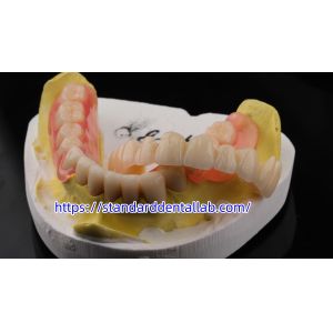 High Esthetics Dental TCS Valplast Flexible Partial Dentures Dental Lab Valplast