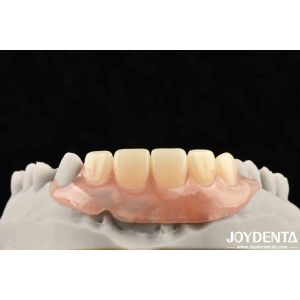 Elaborate Technology Framework Set Up Teeth Finish For Stable Oral Structure In Dental Technology Apply To Dental