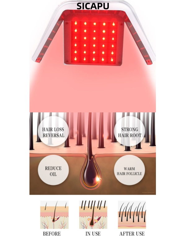 LLLT Red Light Laser Hair Growth Machine  Hair Scalp Therapy for Hair Loss Treatment and Hair Regrowth