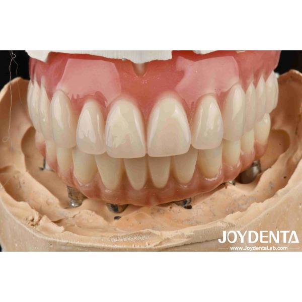 Buy Good Elasticity Dental Acrylic Denture Finish With Tooth Arrangement Technology at wholesale prices