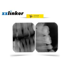 Medical 30KHz 0.1MA 60KV RVG Dental X Ray Machine