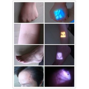 Wireless Electric Derma Hydra Pen H5 Automatic Applicator Professional