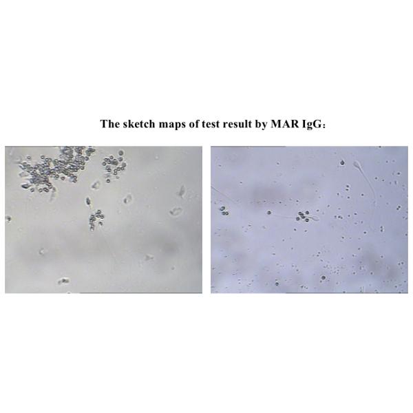 SpermFunc Male Fertility Test Kit For Determination IgG Antibody Coating Spermatozoa