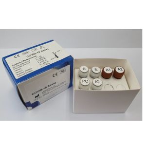 New Virus Assay Rapid Test Device Support Online Technic Easy Operation