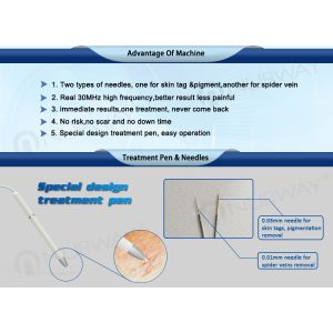 CE approval 30MHZ immediately result Spider Vein Removal Machine
