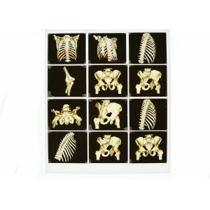 Wearable White Base X Ray Diagnostic Imaging , Medical Laser Blue X Ray Film