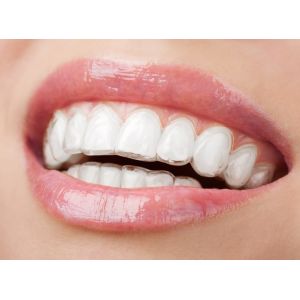 Advanced Technology And Stable Physical Properties Foil Roll For Making Aligners