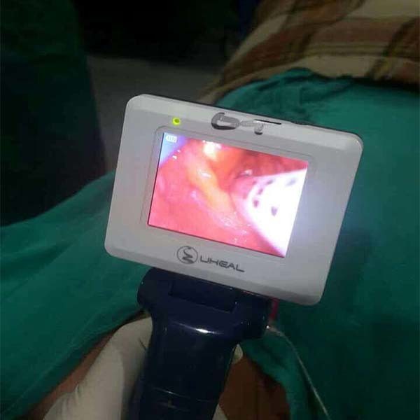 Battery Portable Video Laryngoscope For Adult / Pediatic / Neonate 640*480 Resolution