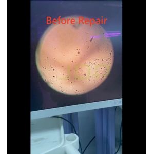 EFER BX 5500 EXTENDED HYSTEROSCOPE SN: P5** FOR REPAIR