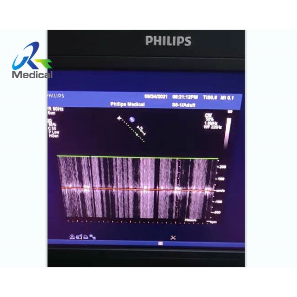 Buy  IE ELITE Ultrasound Machine Repair Clutter Interference Cw Function at wholesale prices