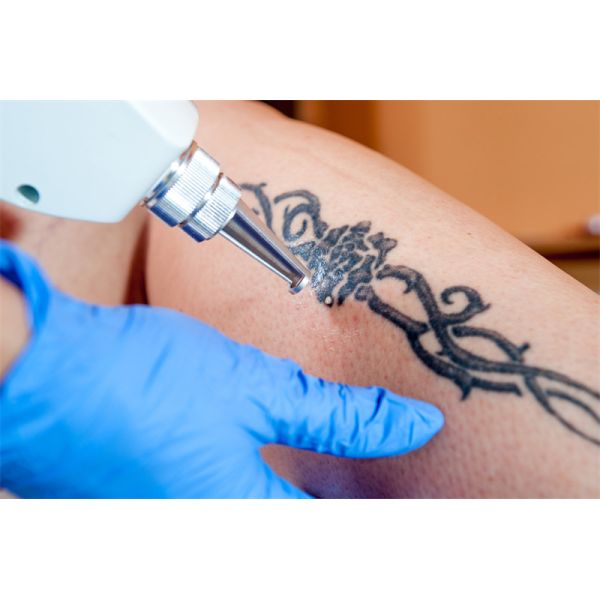 755 808 1064nm Triple Laser Hair Removal Machine 2 Handles Diodo Pico Second Yag Tattoo