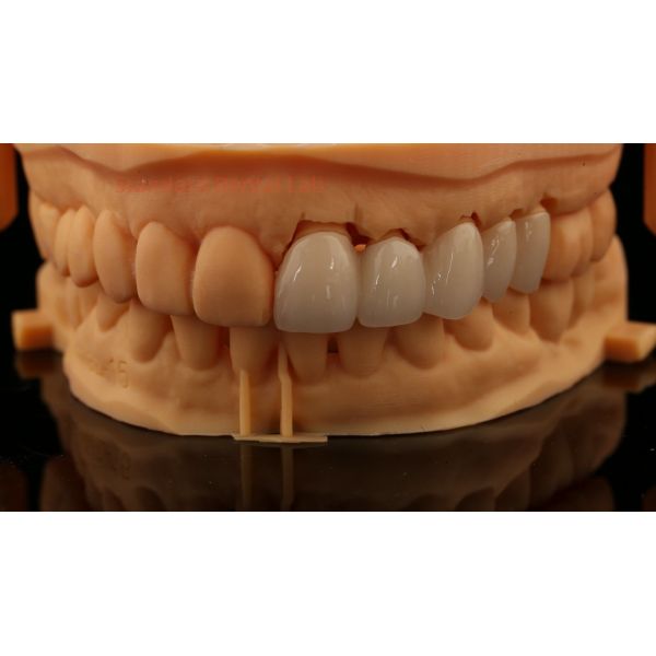 High Aesthetic Anterior Teeth Full Contour Zirconia Crown with Customized Vita Shade Dental Lab