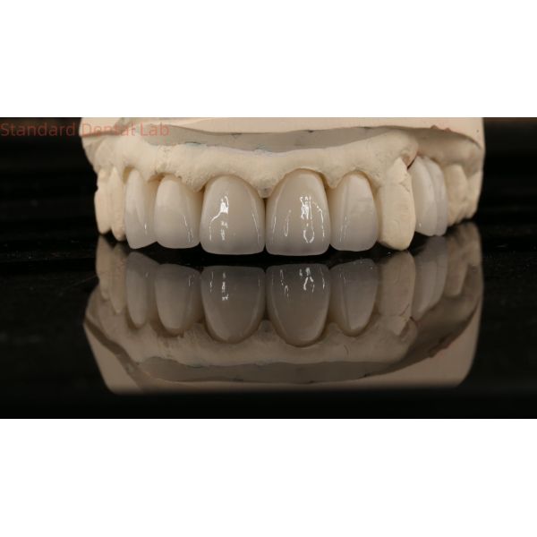 China Dental Lab Zirconia Full Contour Crown High Aesthetic Natural Dental Bridge 5 Year Guarantee