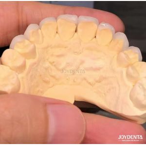 16 Shades Color Emax Dental Veneers A1-A4 High Stain Resistance For Perfectly