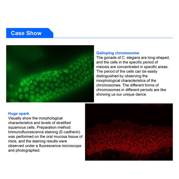 Binocular Wide Field Fluorescence Microscopy A16.2614 40X - 1600X Magnification