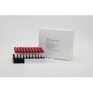 Quality RT PCR 5μL Sample Release Reagent Nucleic Acid Releaser Extraction Of Viral RNA for sale