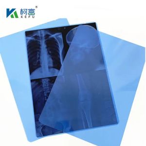 10*12in Medical X-Ray / CT/DR Dry Scan Film For X-Ray Laser Image Printer And Thermal Image Printer Equipment