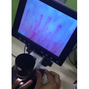 Next Generation Microcirculation Microscope , Blood Vessel Microscope For