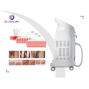 Hair Removal 13*39mm2 755nm 3500W Diode Laser Machine