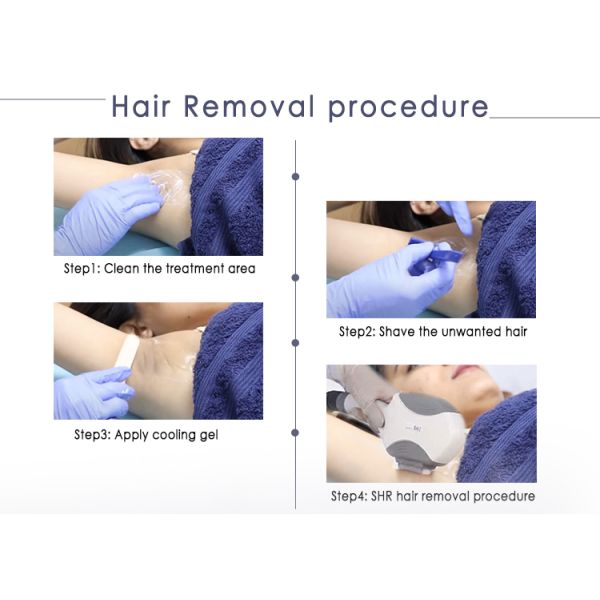 Vertical OPT SHR Skin Rejuvenation Acne Treatment And Pigmentation Removal