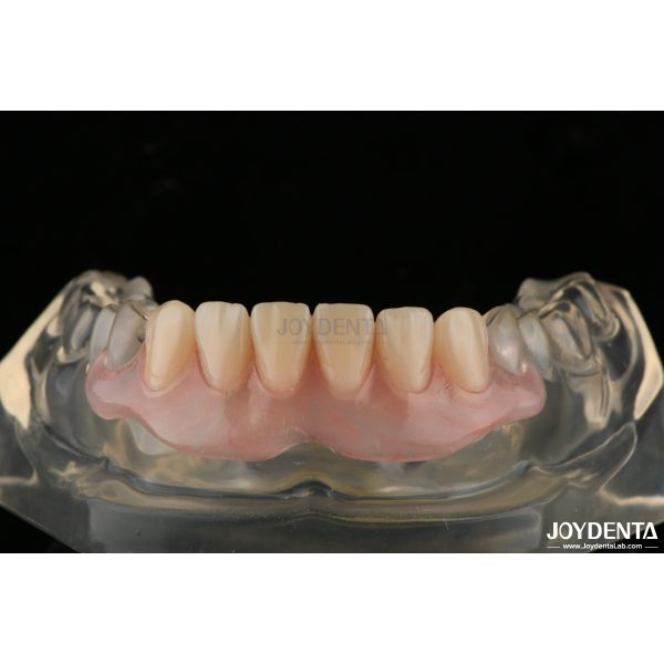 Buy Personalized Invisible Denture Finished With Advanced Tooth Arrangement Technology at wholesale prices