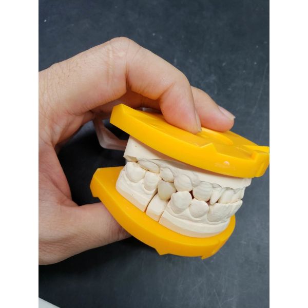 Buy Innovation At The Heart Of Our Ceramic Dental Crowns at wholesale prices