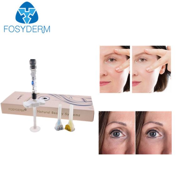 Buy Eye Wrinkle Hyaluronic Acid Dermal Filler Facial Wrinkles Injection Filler at wholesale prices