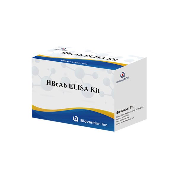 Buy HBcAb Blood Test Elisa Test Enzyme Linked Immunosorbent Assay at wholesale prices
